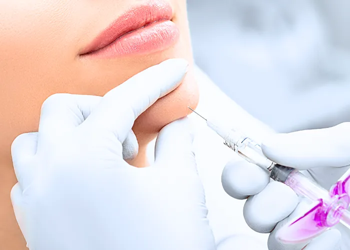 Dermal Fillers