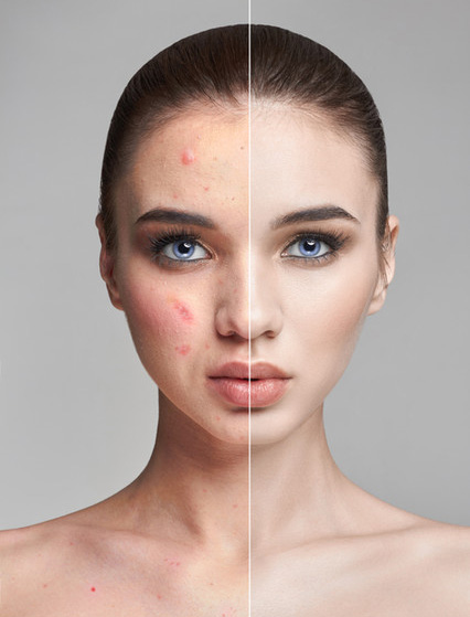 skin pigmentation treatment